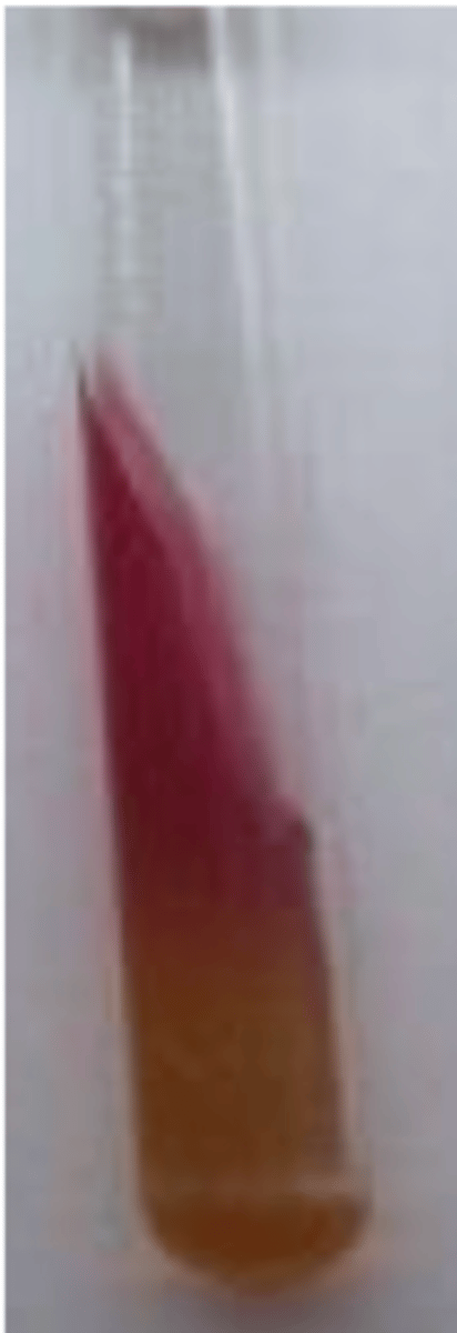 <p>what bacteria in the family Enterobacteriaceae produces this result with a TSI test?</p>