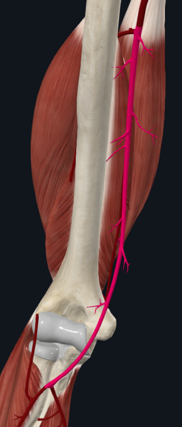 <p>What artery is this</p>