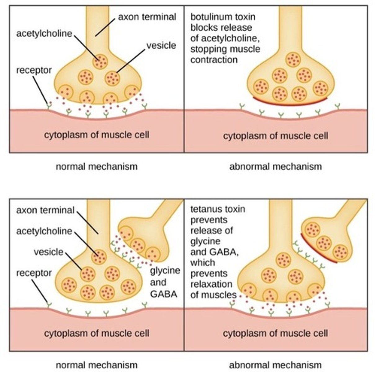 <p>Tetanospasmin toxin travels from wound site to the neuromuscular junction (NMJ).</p><p>Here, it binds to presynaptic membranes of motor neurons and is taken up via vesicles into the axon.</p><p>It interferes with the release of neurotransmitters such as GABA and Glycine</p><p>If GABA cannot inhibit α-motor neurons, the firing rate increases, producing unopposed muscle contraction and spasms (opisthotonus and risus sardonicus)</p>