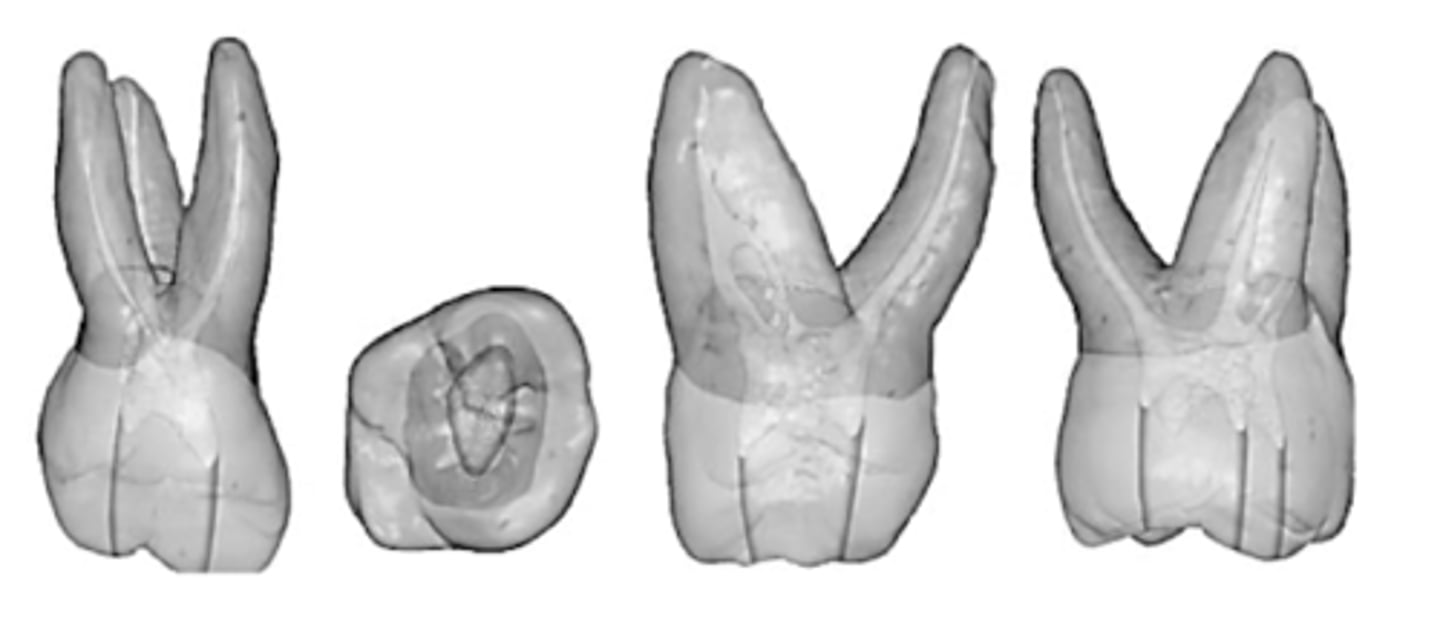 <p>MB</p>