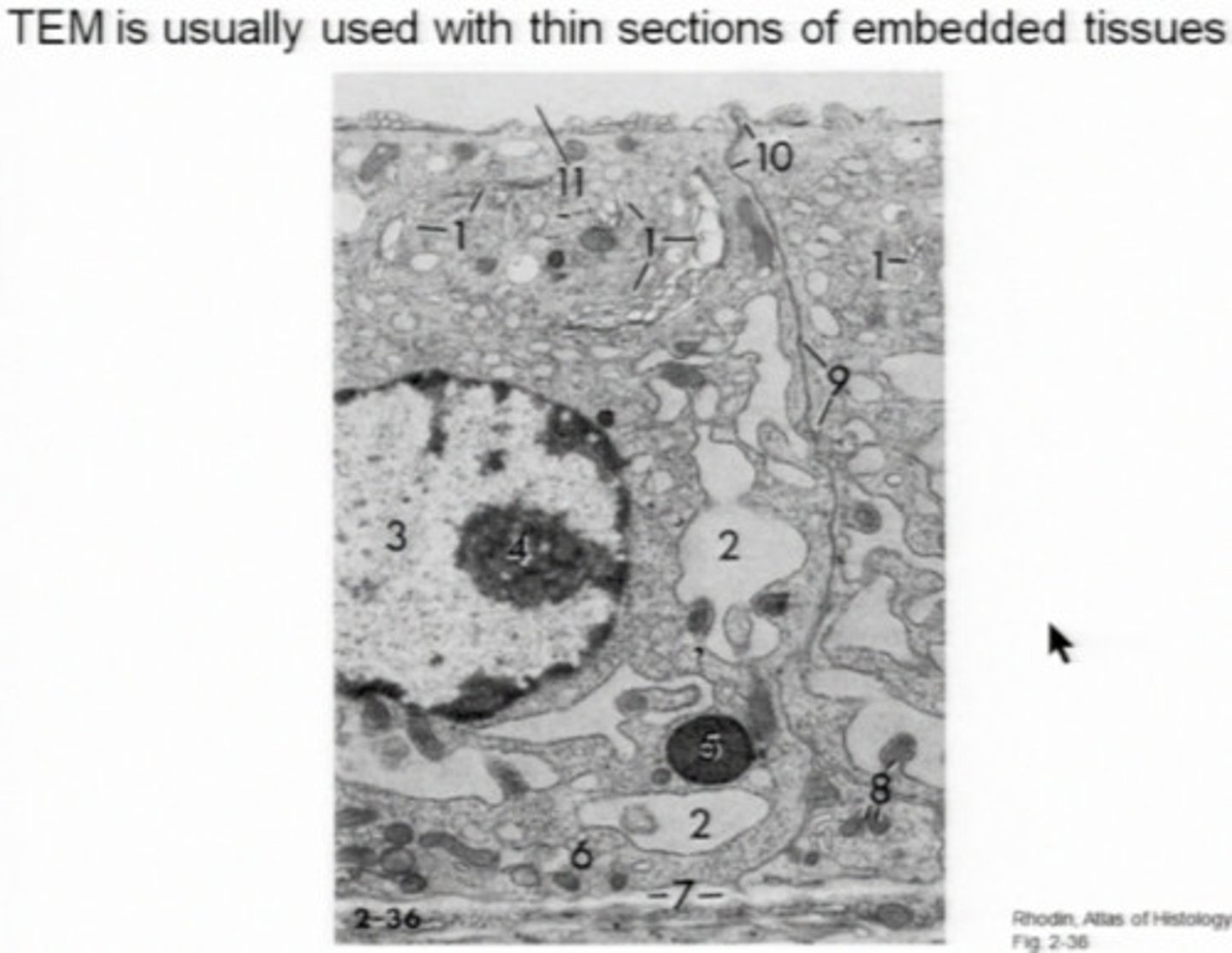 <p>Uses stains made of heavy metals like uranium. The highest resolution is 0.2 nm. You need to make thin sections (20-60nm) for visualization of internal structures. It can magnify up to one million. You can only see the surface, see what is inside, and make slices.</p>