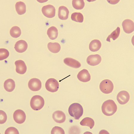 <p>What is the inclusion in this erythrocyte?</p>