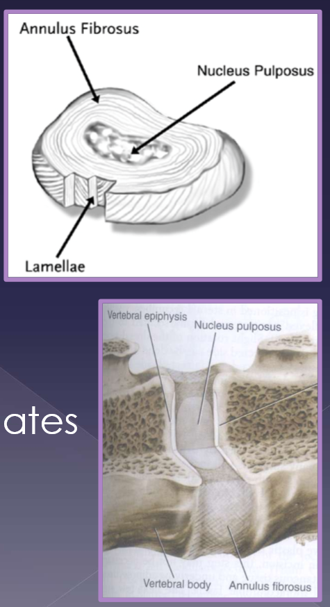 <ul><li><p>#1 most common in general practice </p><ul><li><p>2 components </p><ul><li><p>annulus fibrosus </p><ul><li><p>parallel arrangement of lamellae </p></li><li><p>thicker ventrally </p></li></ul></li><li><p>nucleus pulposus </p><ul><li><p>located centrally (eccentric)  </p></li></ul></li></ul></li><li><p>cartilagenous vertebral end plates </p><ul><li><p>source of nutrients via diffusion </p></li></ul></li></ul></li></ul><p></p>