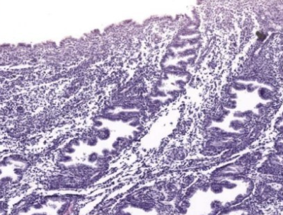 what phase of endometrial cycle