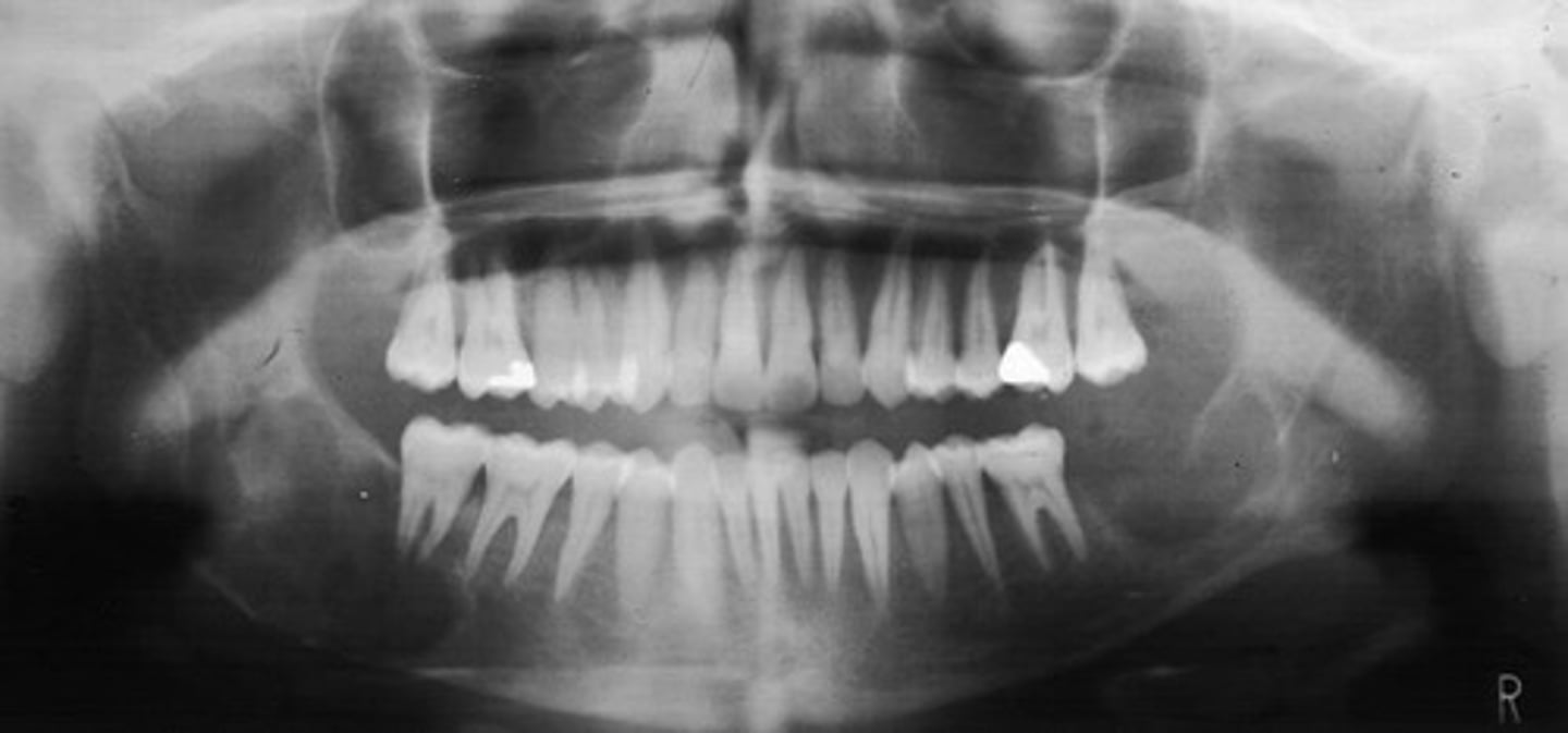 <p>How would you describe the lesion?</p>