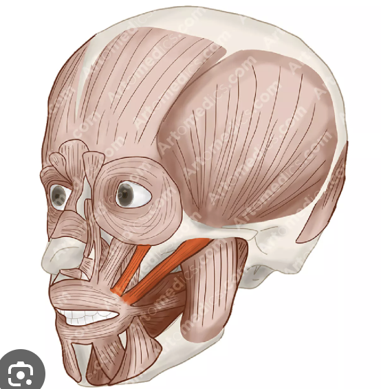 term image