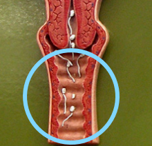 <p>Vagina</p>