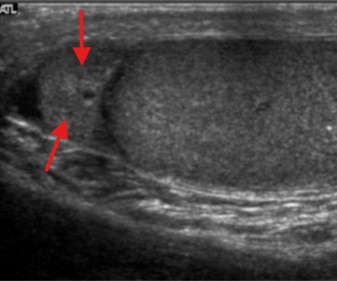 <p>What structure is seen here?</p>