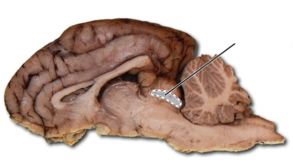 <p>Name the part of the brain that is highlighted.</p>