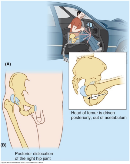 <p><span>can be reset </span></p><ul><li><p>MVA</p></li></ul><p></p>