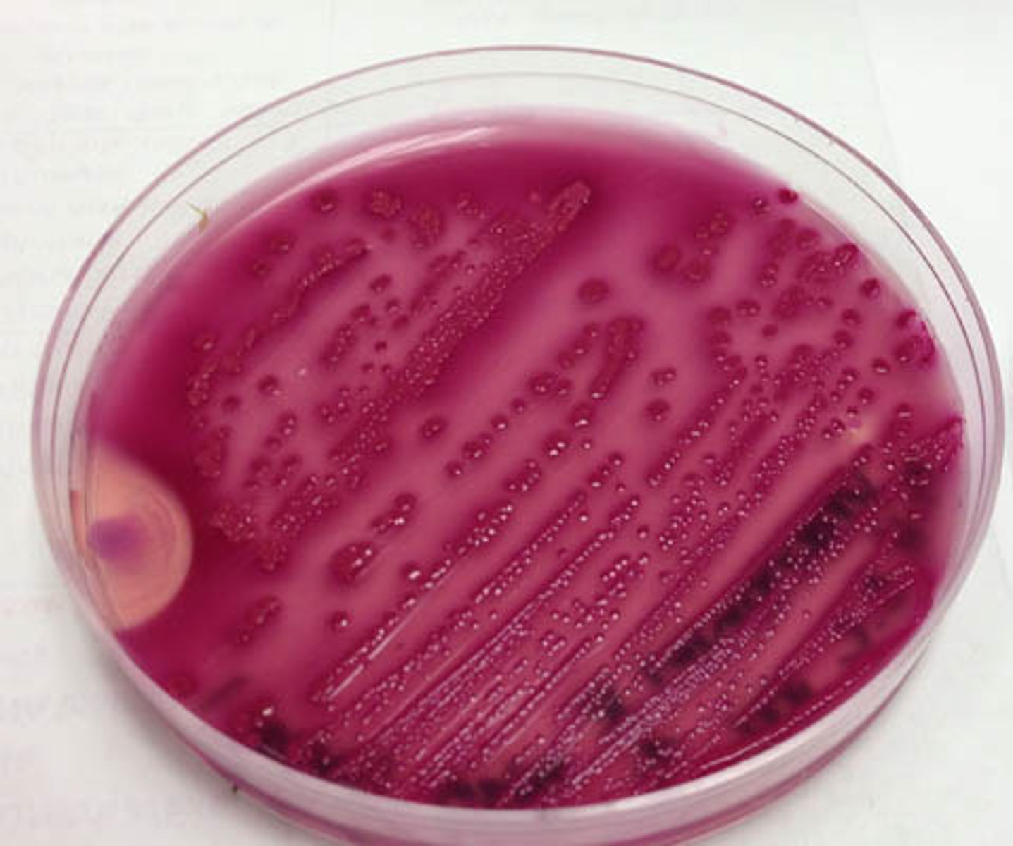 <p>LF (pink)</p><p>Indole negative </p>