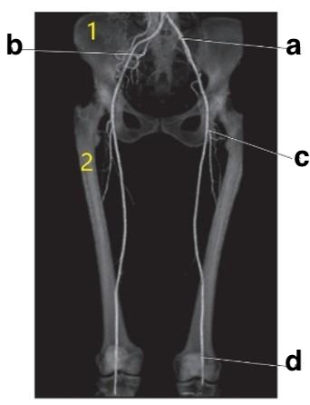 <p>What is letter d?</p>