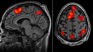 <p><strong>can show which areas of your brain are most active</strong><span>. Tracking and comparing that activity to what you were doing at the time can help “map” your brain activity. <strong>Structure+Function</strong></span></p>