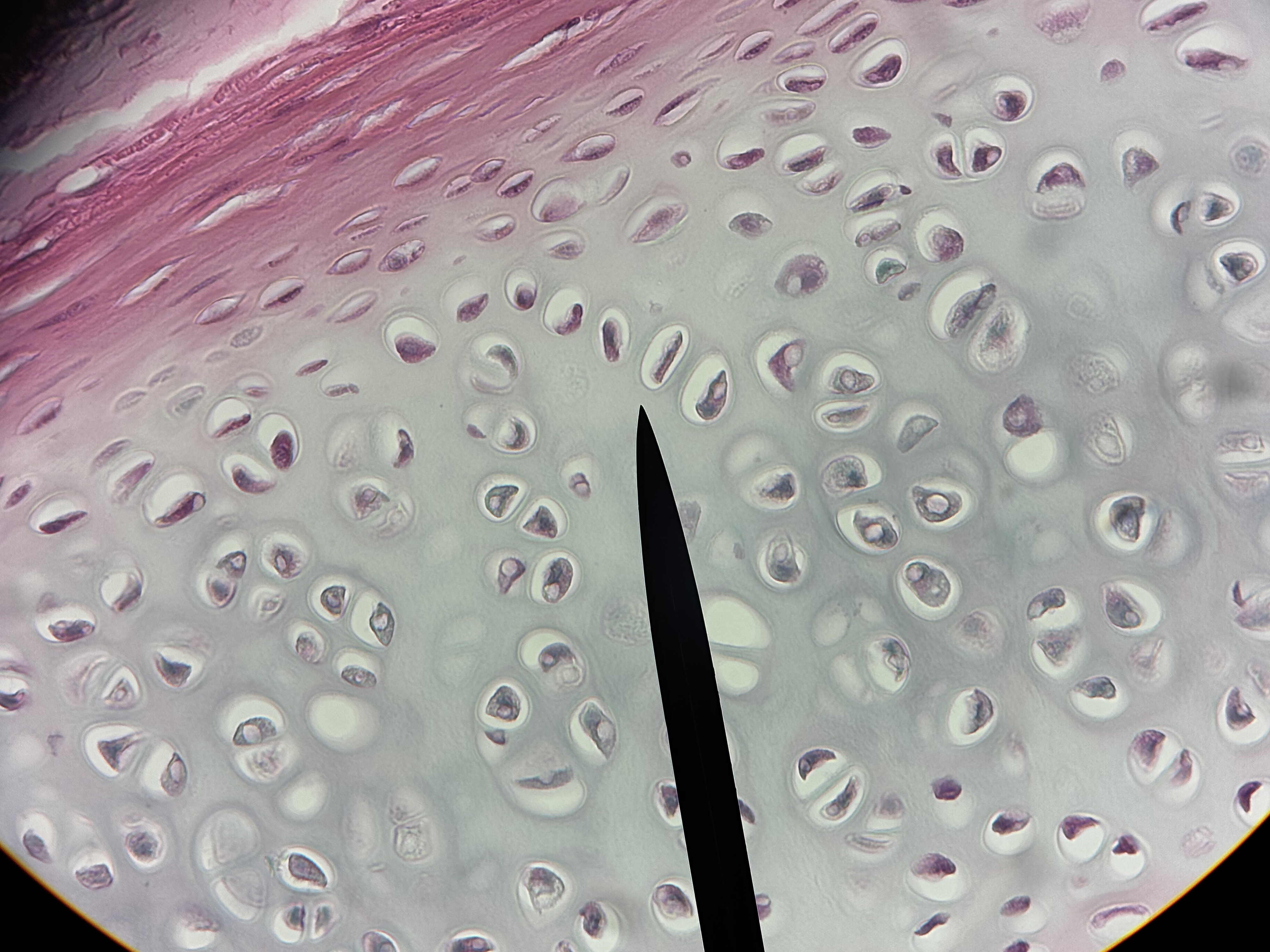 <p><span>Hyaline cartilage</span></p>