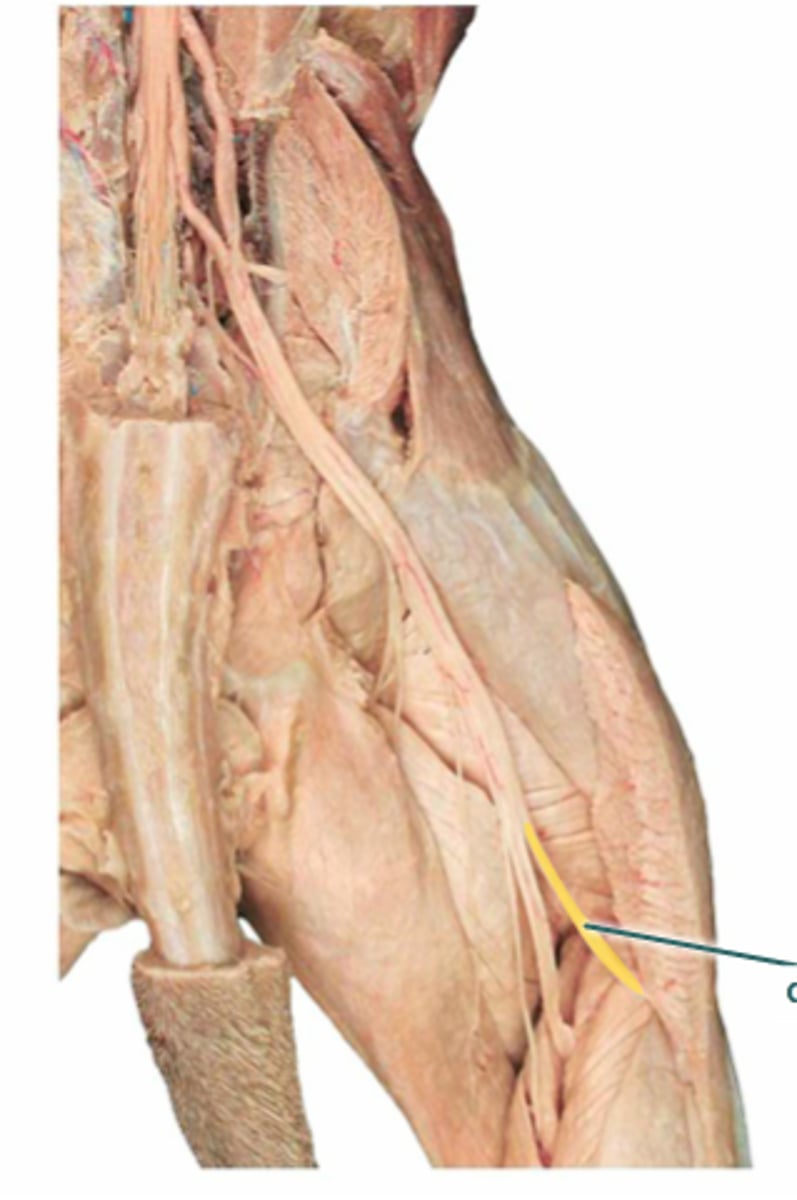 <p>What is the name of the yellow highlighted nerve?</p>