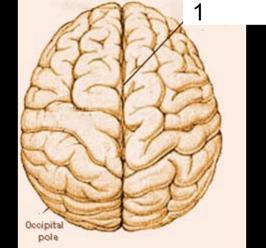 <p>What structure of the brain is this? #1</p>