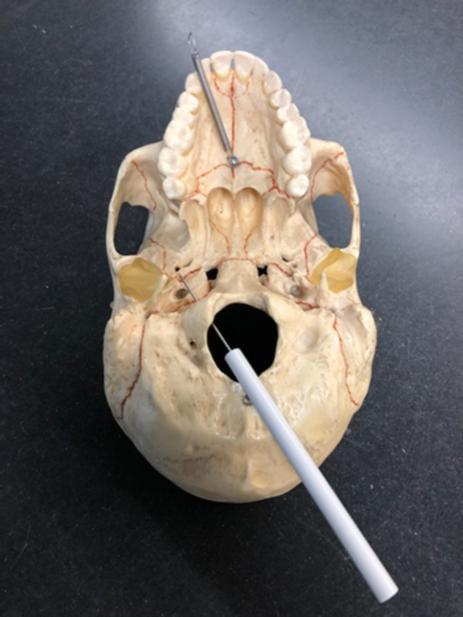 <p>Hole that goes through condyles</p>