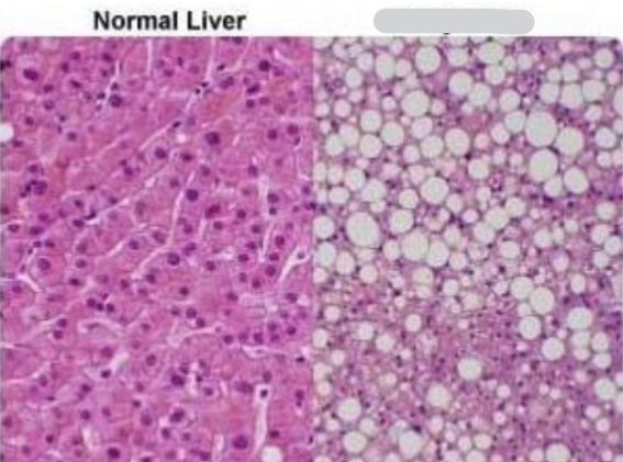 <p>This Liver tissue has changed due to injury. Why type of change has occurred</p>