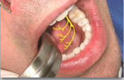 <p>what nerve is depicted here?</p>