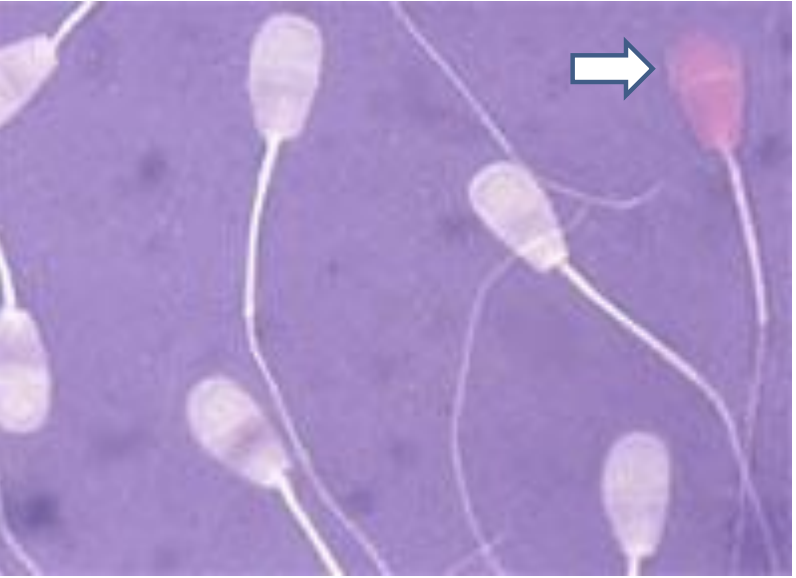 <p>Đây là tinh trùng sống hay chết ?</p>