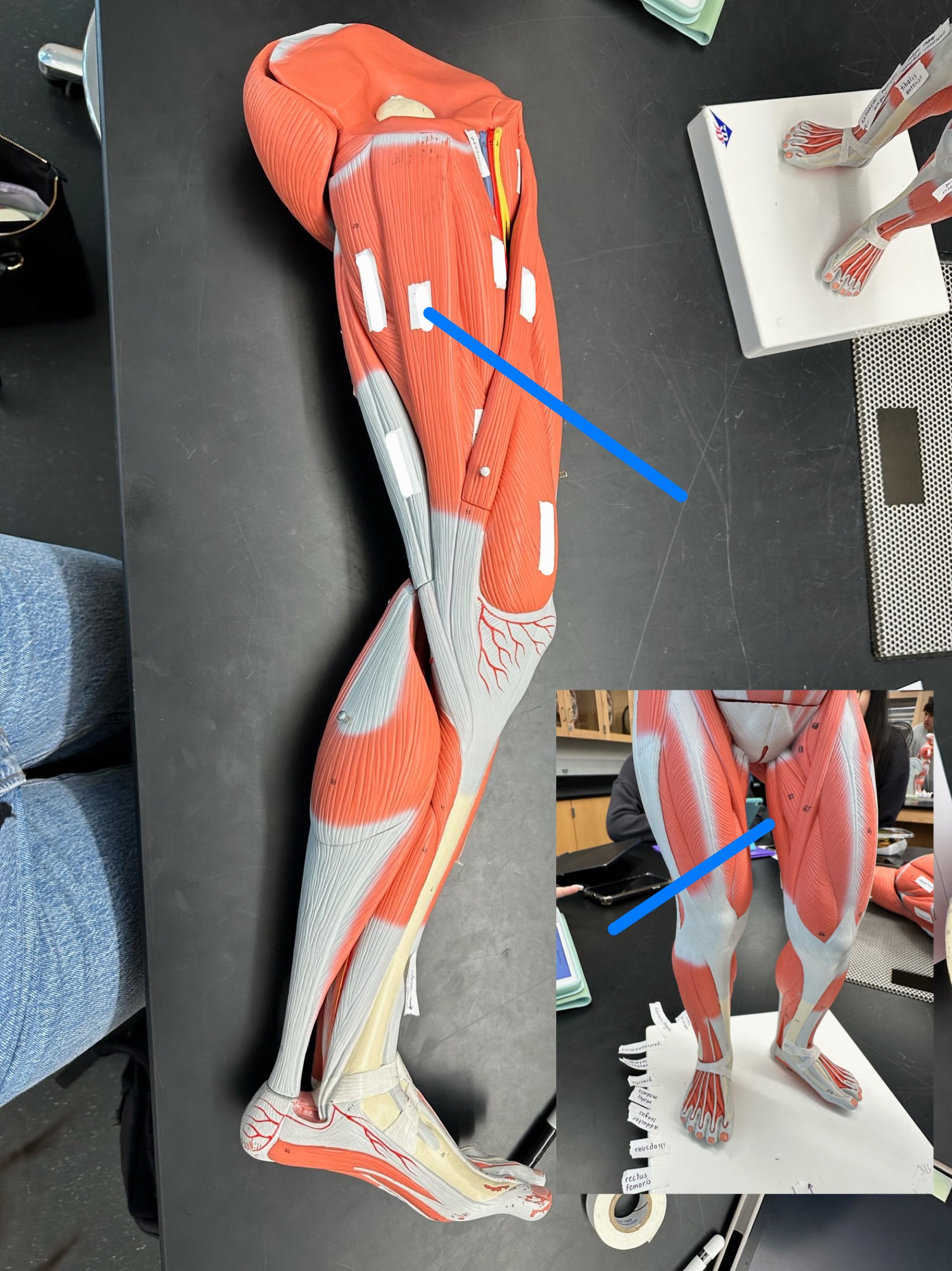 <p>ID muscle</p>
