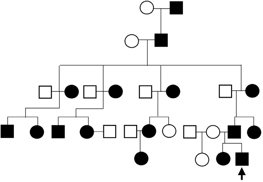 * rare (often unusual to see homozygous dominant individuals if severe phenotype) 
  * *NOTE: for autosomal dominant diseases, assume anyone affected with the disease is a heterozygote unless otherwise stated*
* males and females (usually) equally affected (autosomal) 
* affected individuals have an affected parent (dominant) 
* doesn’t skip generations (dominant) 