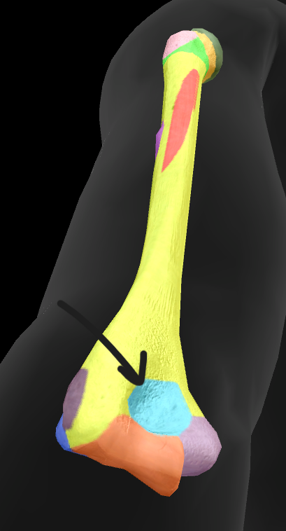 term image