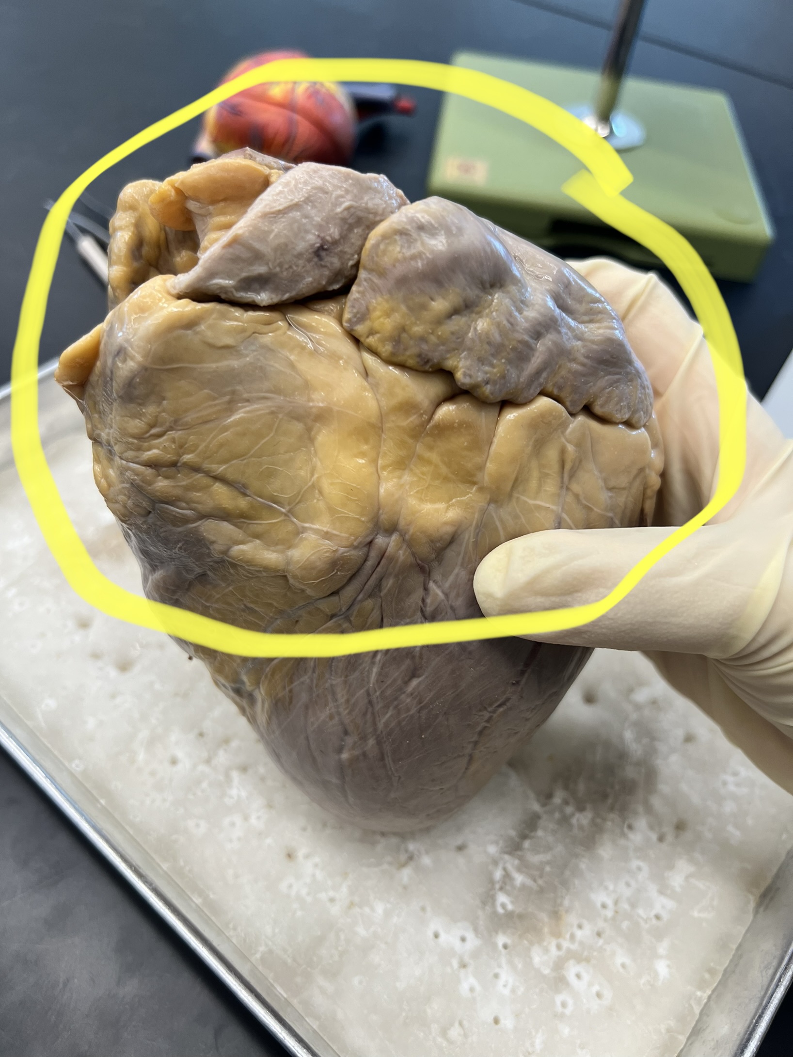 Name the heart structure.