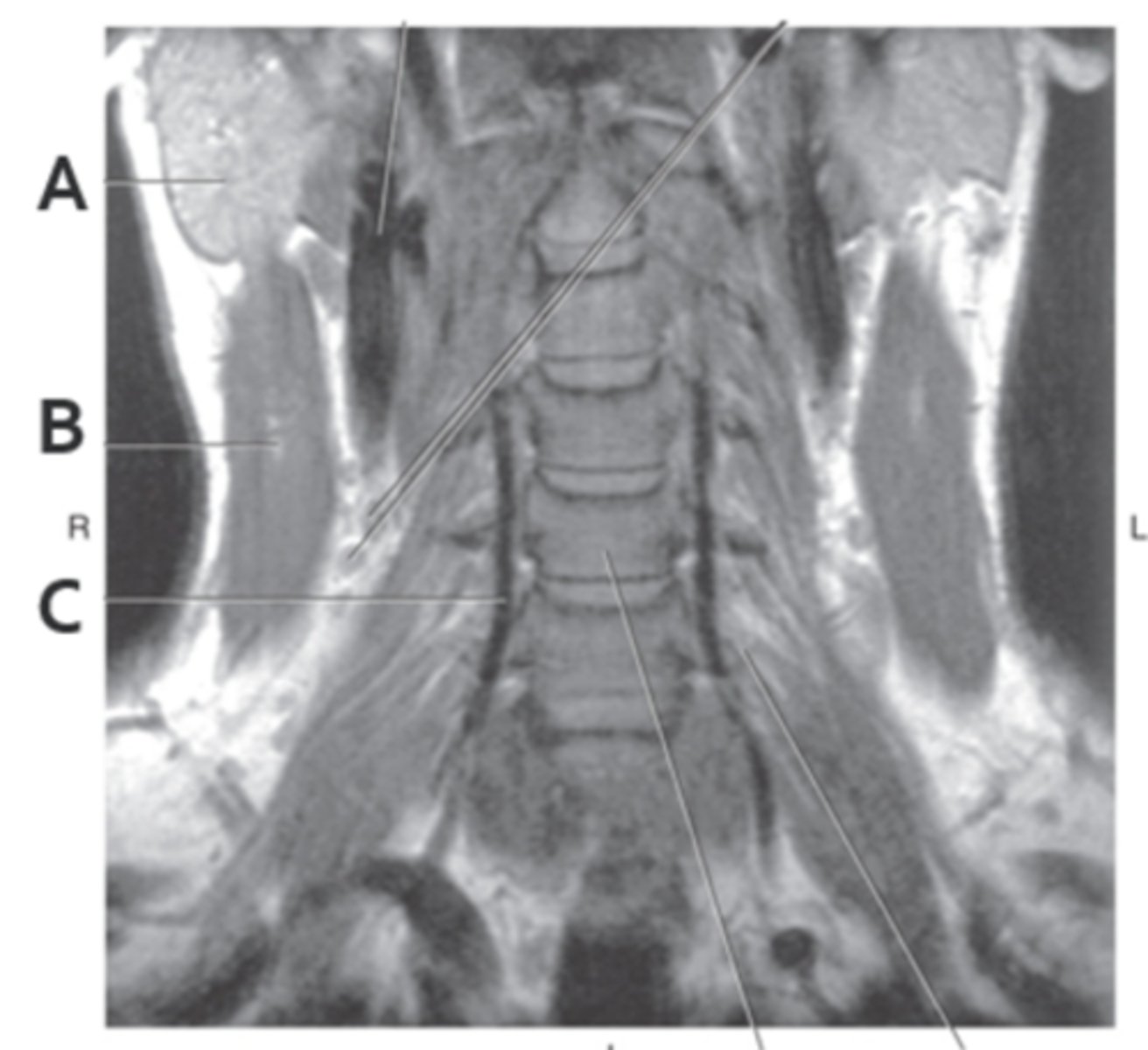 <p>Label B</p>