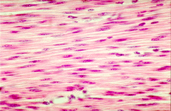 This muscle tissue is found in walls of hollow organs other than the heart