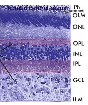 <ol><li><p><strong>Retinal pigment epithelium</strong></p><ul><li><p>single layer of pigmented cells; absorbs stray light and nutrient/waste exchange</p></li></ul></li><li><p><strong>Photoreceptor layer</strong></p></li><li><p><strong>Outer limiting membrane</strong></p><ul><li><p>fusion of photoreceptor cell membranes; basis of electrical charge of retina</p></li></ul></li><li><p><strong>Outer nuclear layer</strong></p><ul><li><p>cell bodies of photoreceptors</p></li></ul></li><li><p><strong>Outer plexiform layer</strong></p><ul><li><p>synapses between photoreceptors and bipolar/horizontal cells</p></li></ul></li><li><p><strong>Inner nuclear layer</strong></p><ul><li><p>cells bodies of bipolar cells, amacrine cells, horizontal cells</p></li></ul></li><li><p><strong>Inner plexiform layer</strong></p><ul><li><p>synapses between bipolar/amacrine and ganglion cells</p></li></ul></li><li><p><strong>Ganglion cell layer</strong></p><ul><li><p>cell bodies of ganglion cells; send axons out</p></li></ul></li><li><p><strong>Nerve fiber layer</strong></p><ul><li><p>axons of ganglion cells that exit the lamina cribrosa and form the optic nerve</p></li></ul></li><li><p><strong>Inner limiting membrane</strong></p><ul><li><p>footplate of Muller cells (glial cells), highly reflective in younger patients</p></li></ul></li></ol><p></p>