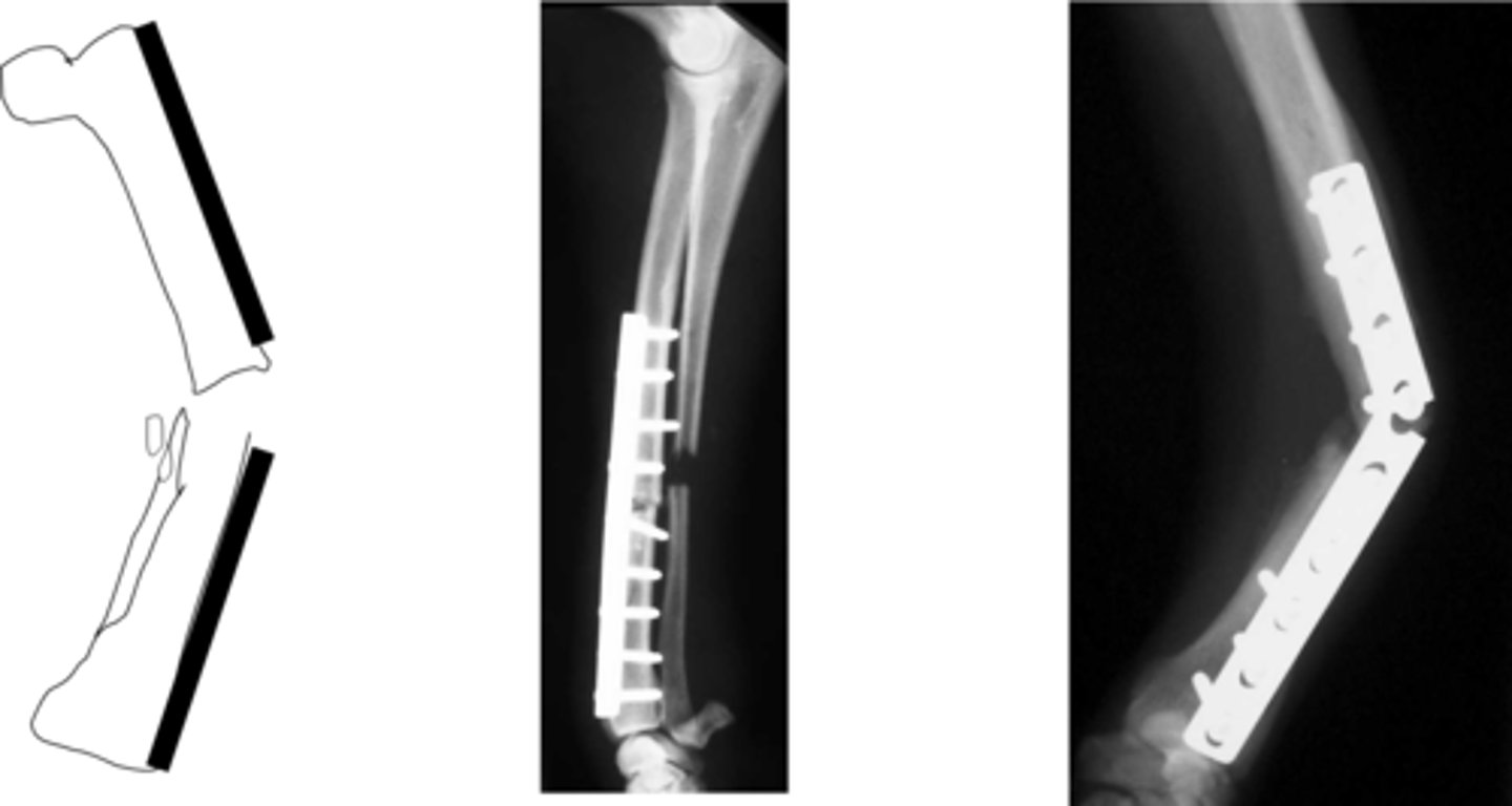 <p>-trans cortex and radius incomplete compounded by absence of section of ulna</p><p>-plate exposed to cyclical loading and failure, are prone to bending</p><p>-in humerus, femur and tibia can be managed with IM pin, rod plate combo</p>