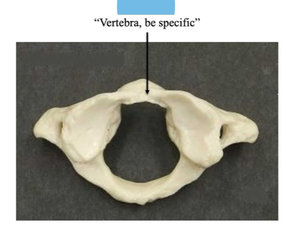 <p>Name this vertebra <strong>be specific </strong></p>