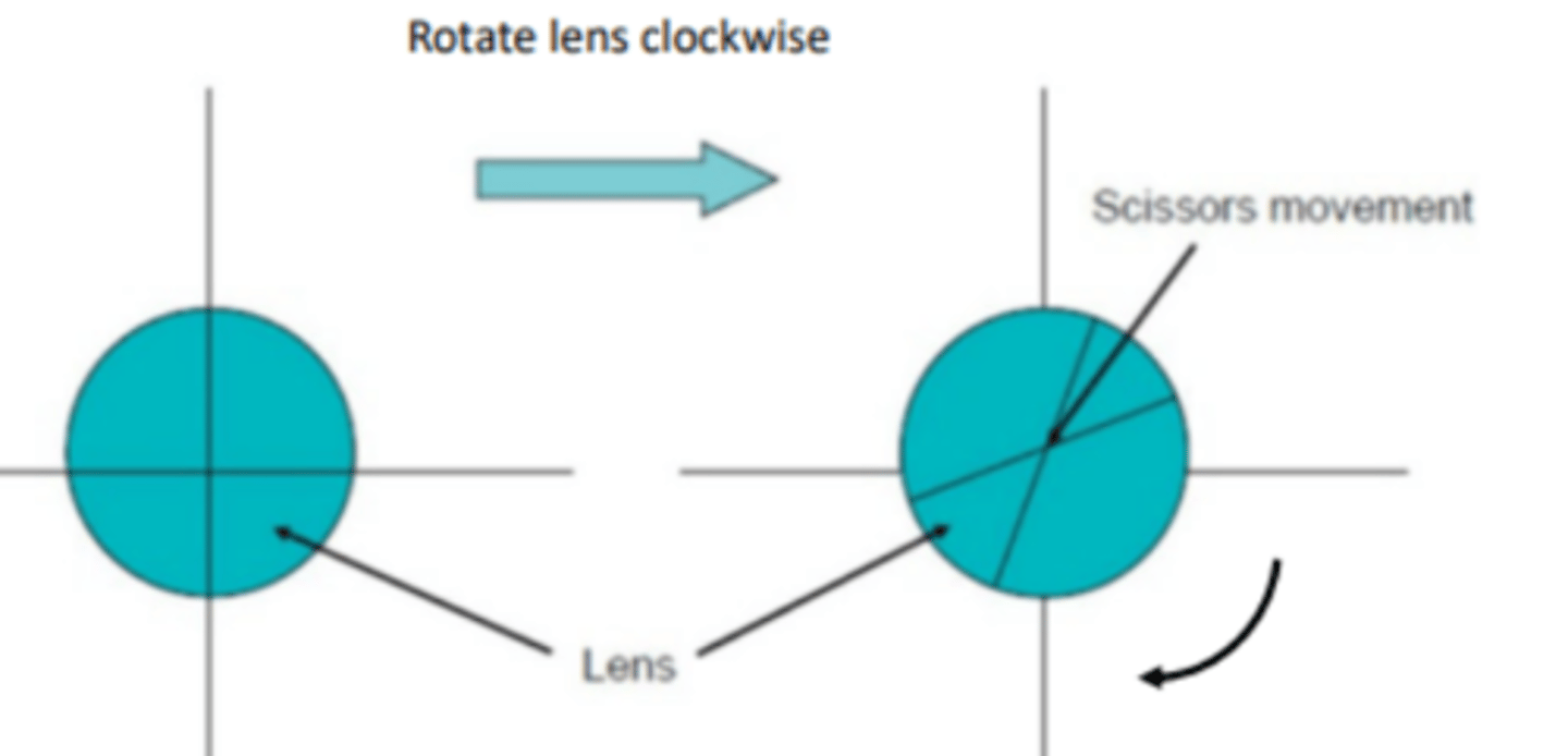<p>If the cross shows a scissor movement with rotation, then you know it is a _____ lens.</p>