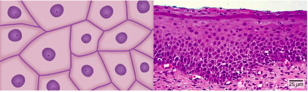 squamous cell shape