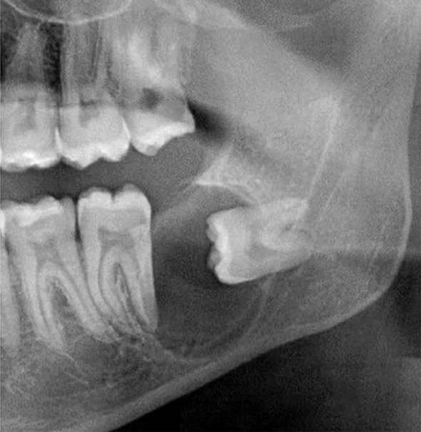 <p>how would you descrribe the location on this lesion</p>