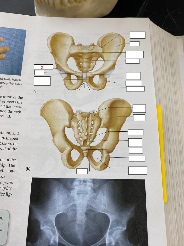 hip socket
