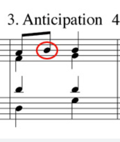 <p>Either by step or leap</p><p>Resolved in same note</p><p>Unaccented</p>