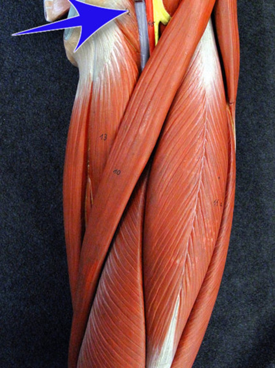 <p>A muscle that adducts and flexes the thigh.</p>