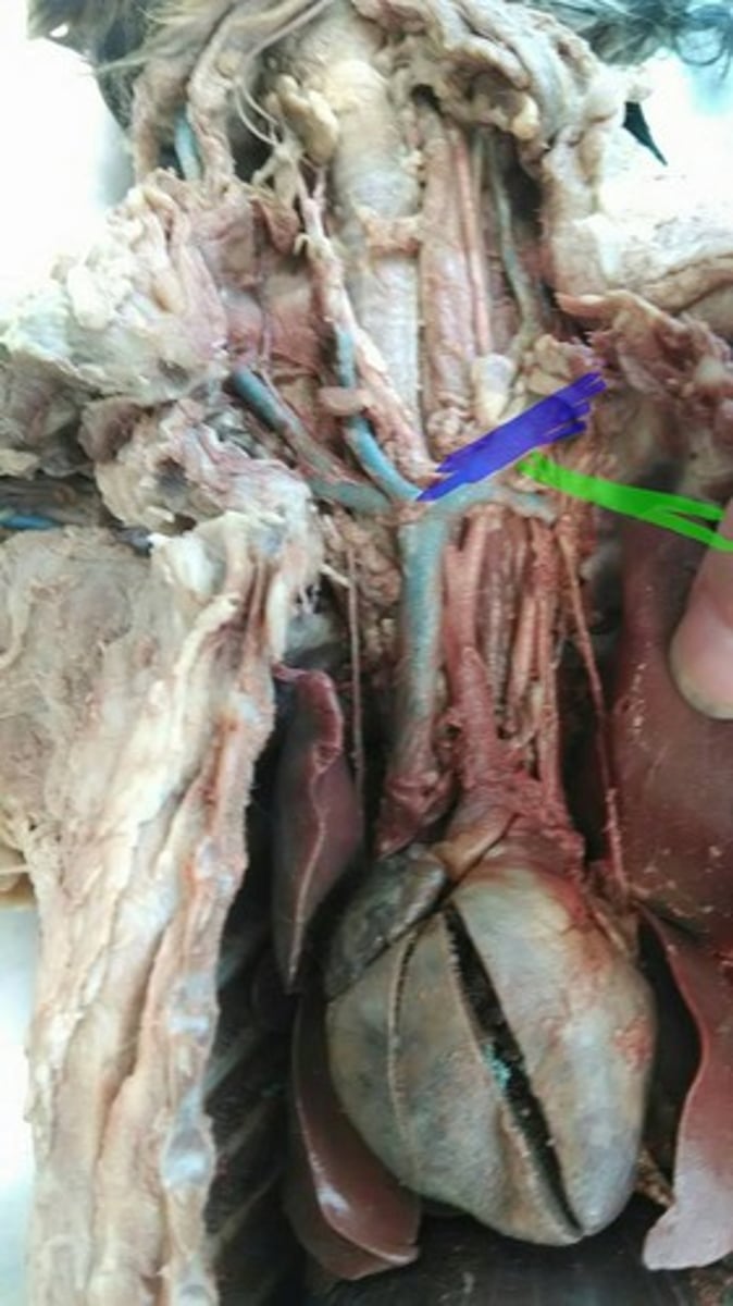 <p>artery; branches off of brachial artery</p>