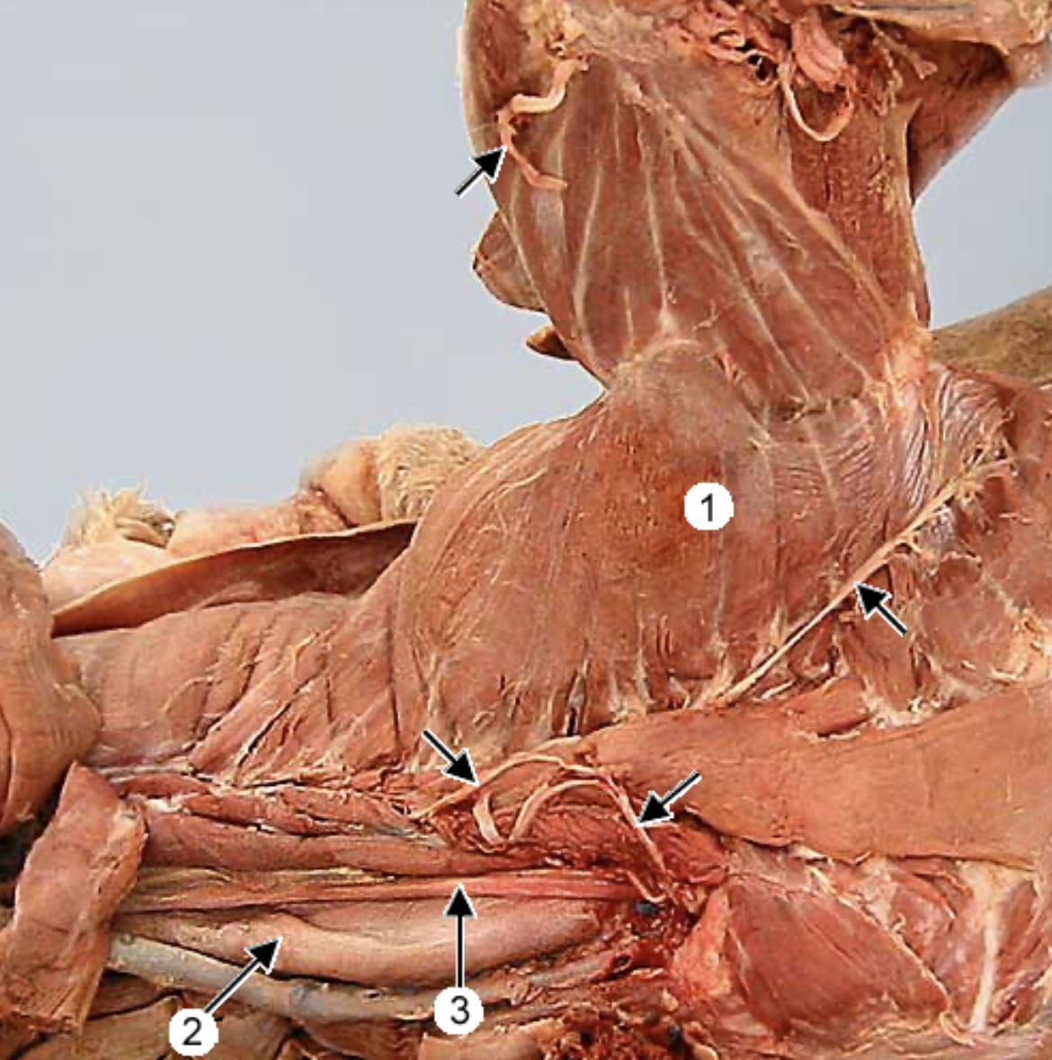 <p>Serratus ventralis m. #1</p>