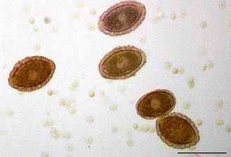 <p>Largest nematode in companion animals, transmitted through earthworms, live in right kidney</p>