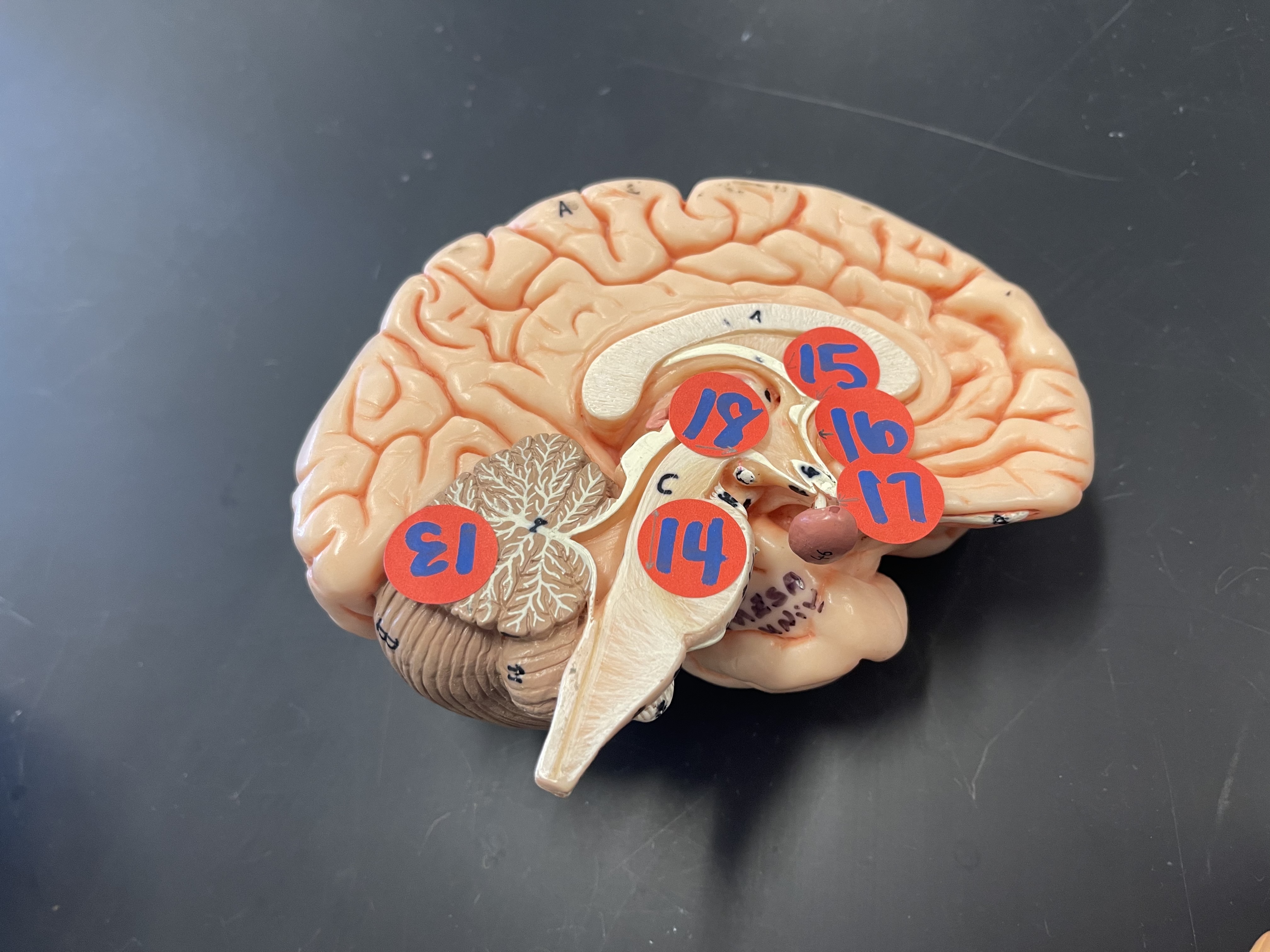 16)what is this structure 