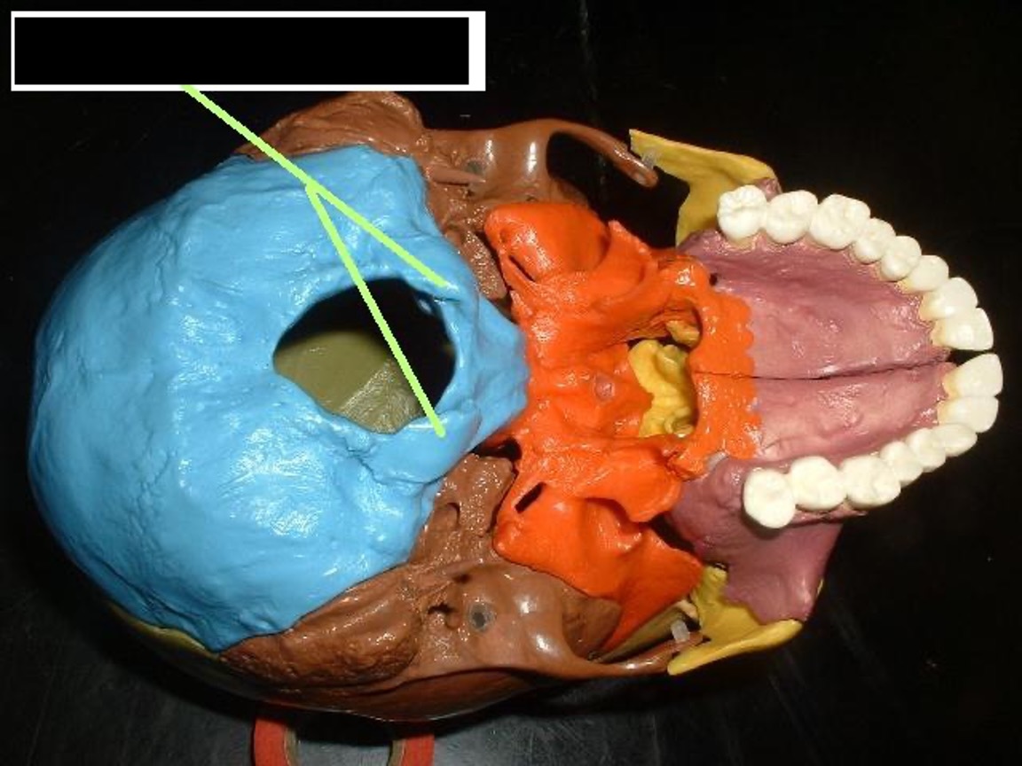 <p>bumps on the sides of the foramen magnum</p>