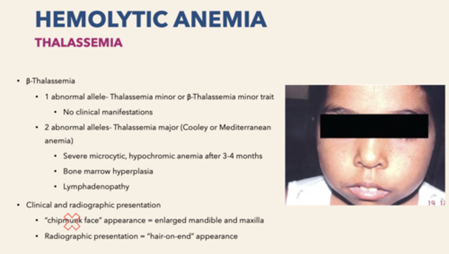 <p>Thalessemia major (Cooley/Mediterranean anemia)</p>
