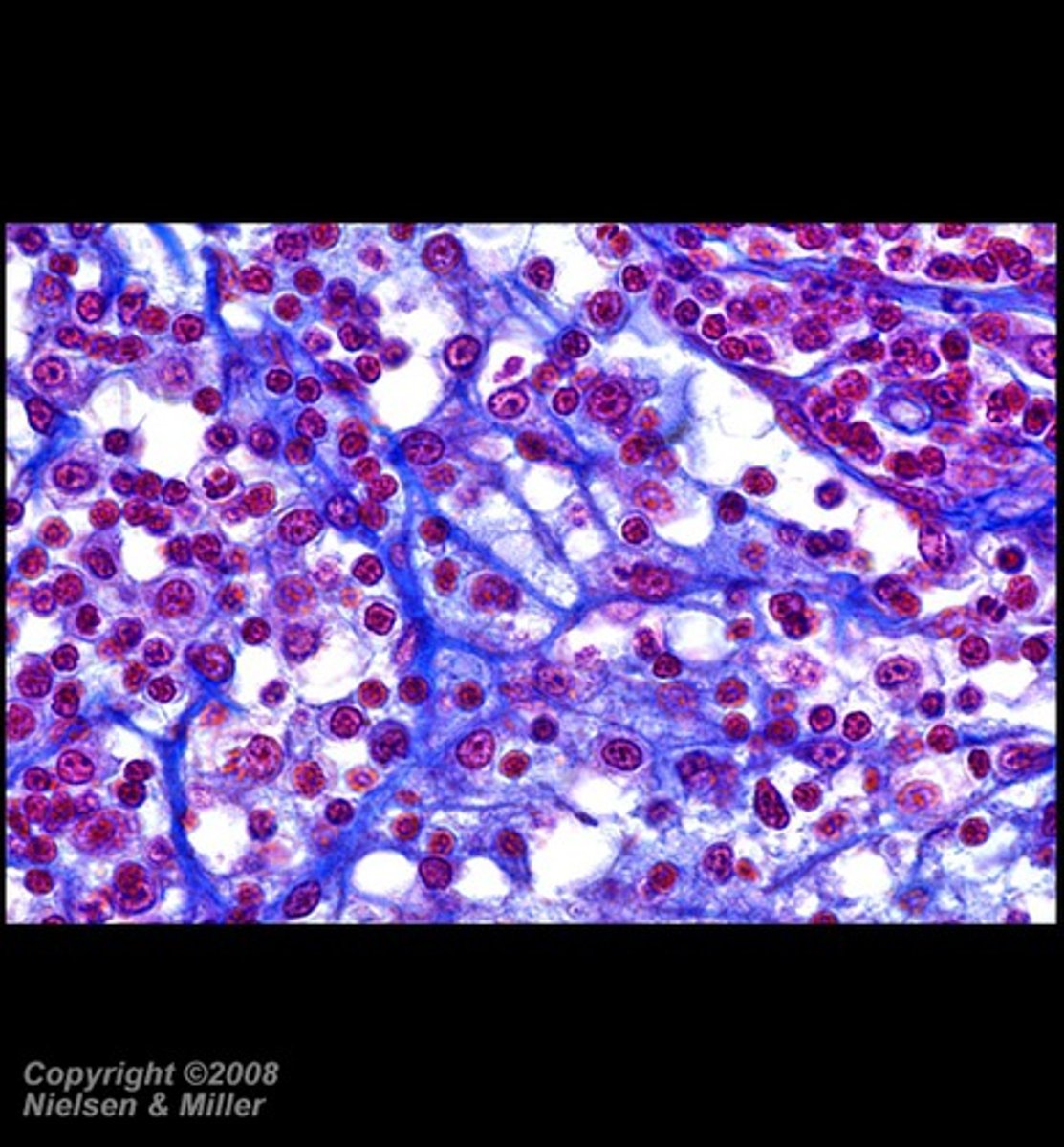 <p>A complex network of nerve fibers within a brainstem that arouses the cerebrum; a type of connective tissues that cross link and from a fine meshwork</p><p>Found in: Lymph nodes, Spleen, Bone marrow</p>