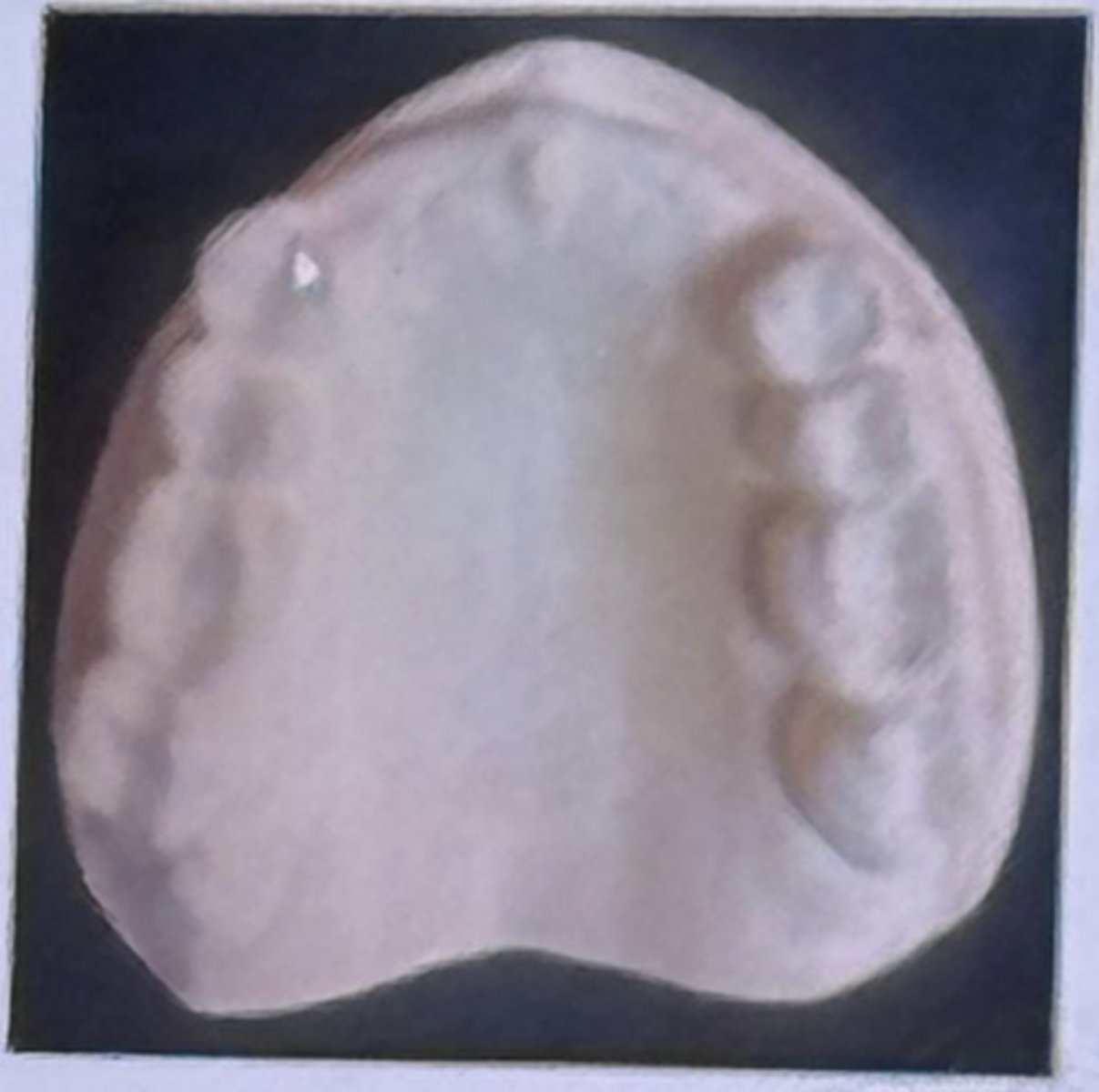 <p>A. Both statements are correct</p>