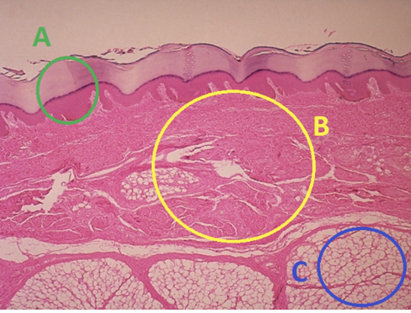 <p>Answer the following questions based on the features indicated in the following image. Which letter indicates the administration site for topical creams and ointments?</p>