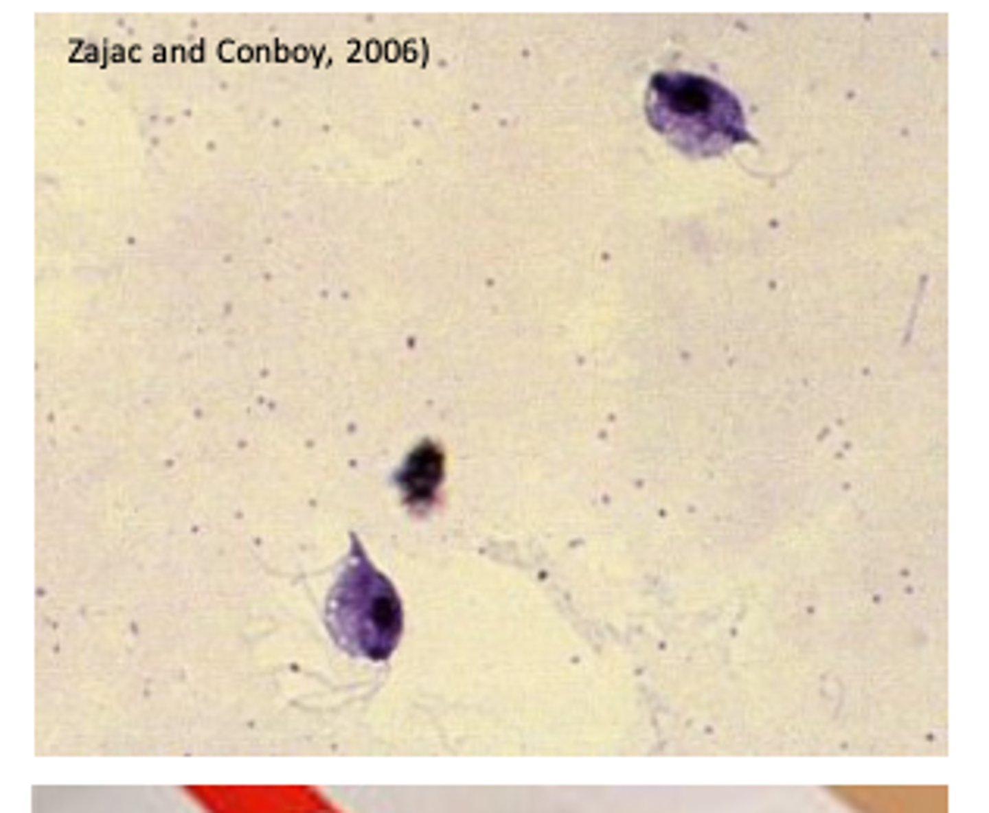 <p>• Clinical signs</p><p>• Identification of the trichomonads</p><p>- In wet smears</p><p>- Cultures = higher sensitivity </p><p>Differential diagnosis</p><p>Vitamin A deficiency;</p><p>Infections with Candida spp, Aspergillus spp, poxvirus, Capillaria</p><p>spp.</p>