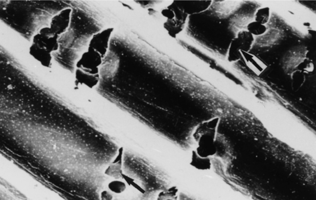 <p>cavitation bacteria</p>